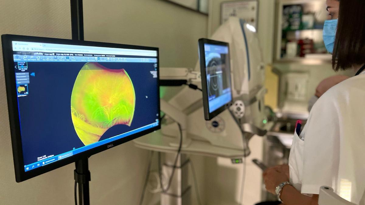 Nuevo equipo para fotografiar la retina incorporado al departamento de salud de Torrevieja