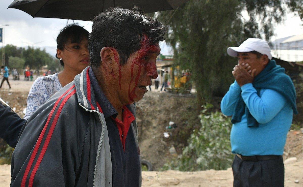 BOL11 COCHABAMBA (BOLIVIA).- 06/11/2019.- Un hombre sale herido cuando grupos de manifestantes se enfrentan entre si este miércoles en Cochabamba (Bolivia). La ciudad boliviana de Cochabamba, una de las principales urbes del país, registra este miércoles choques entre partidarios y detractores del presidente de Bolivia, Evo Morales, que se prolongan durante varias horas. EFE/Jorge Ábrego