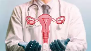 Pólipos uterinos: Descubre qué son los y cómo pueden afectarte