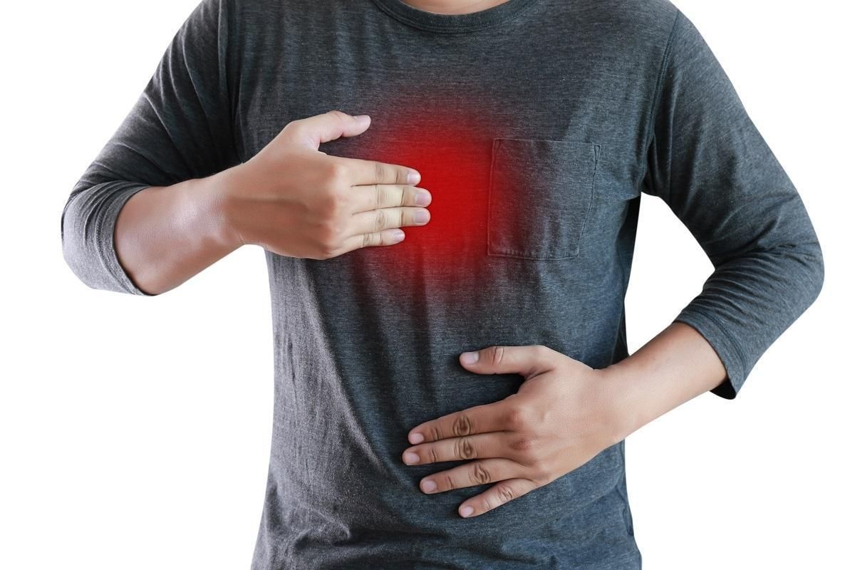 Una de las complicaciones graves de la hernia de hiato es la neumonía por aspiración.