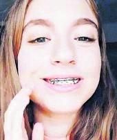 Una adolescente se coloca unos brackets falsos. | TikTok   