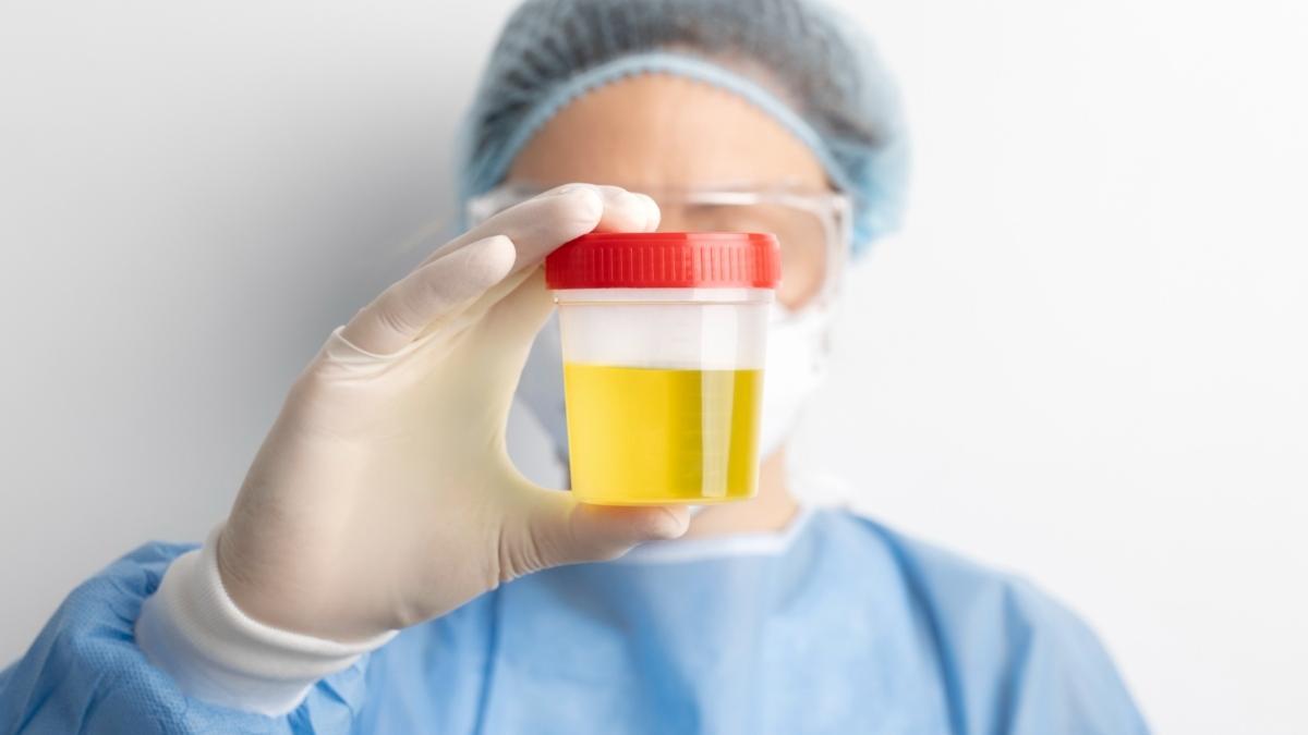 Con el color de la orina podemos interpretar si tenemos algún problema de salud
