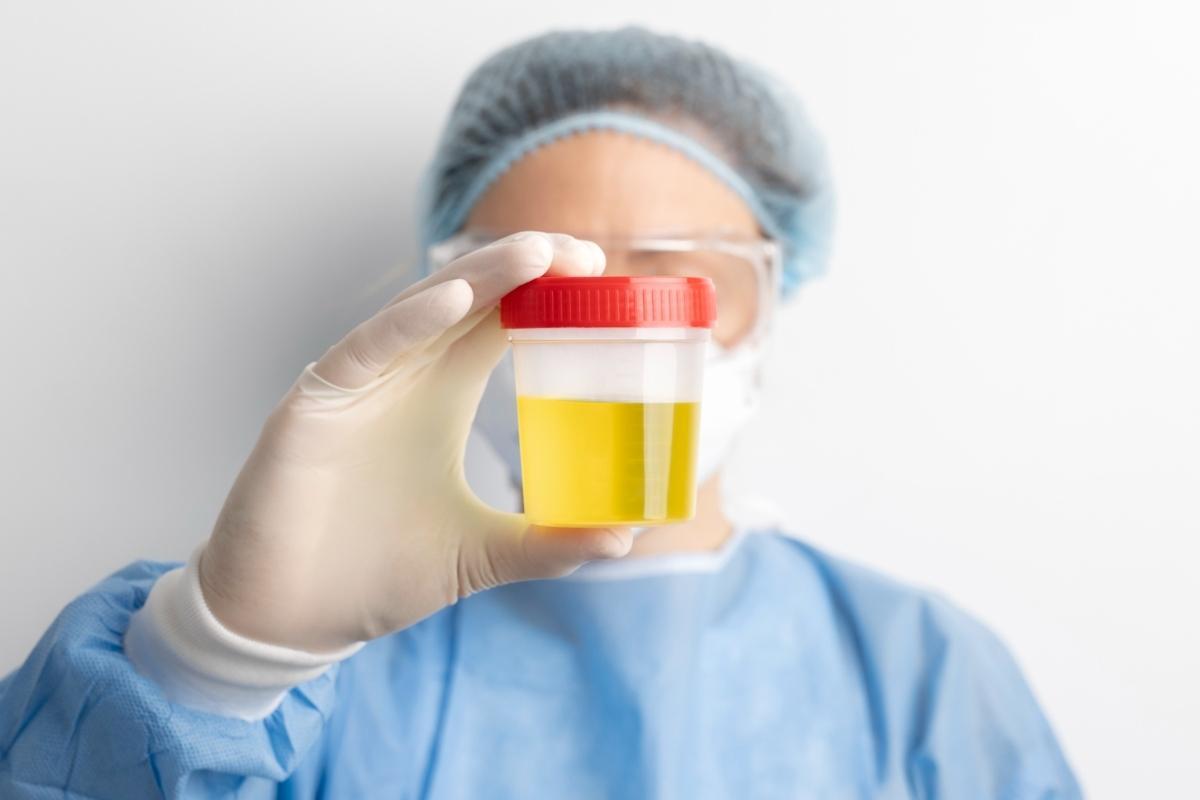 Con el color de la orina podemos interpretar si tenemos algún problema de salud