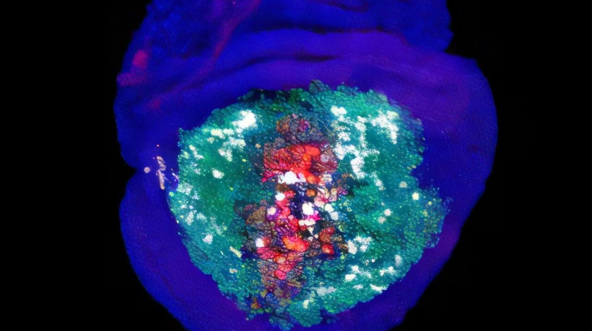 Un disco de células necrosadas del ala de una mosca de la fruta que experimenta regeneración.