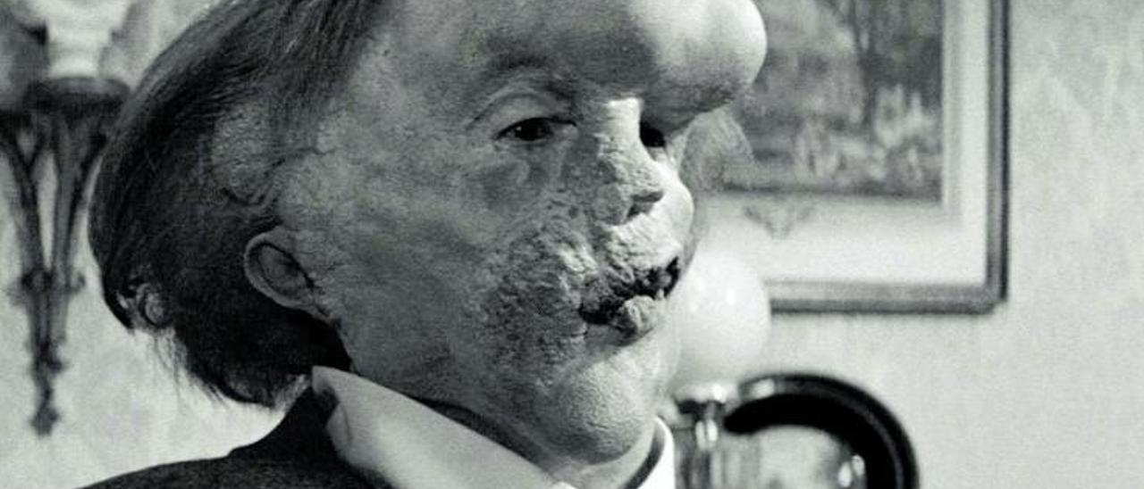 Fotograma de ‘El hombre elefante’, de David Lynch..