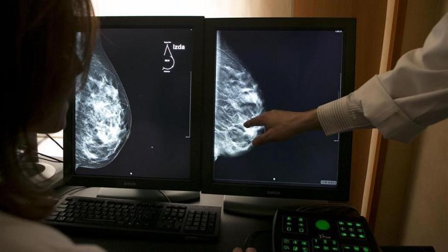 Los médicos piden que la cirugía del cáncer de mama incluya buen resultado estético