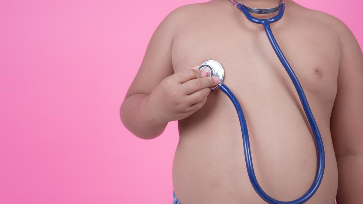 Obesidad infantil: causas, prevención y tratamiento para esta enfermedad en niños