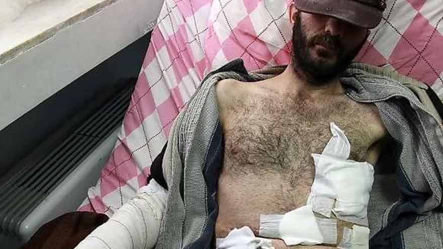Un miliciano rebelde, en un hospital situado en la frontera entre Siria y Turquía.