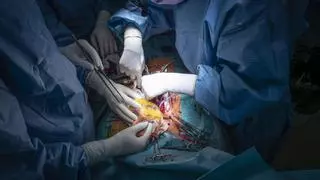 Las negativas a donar órganos en Catalunya aumentan y se sitúan ya en el 28% este 2025