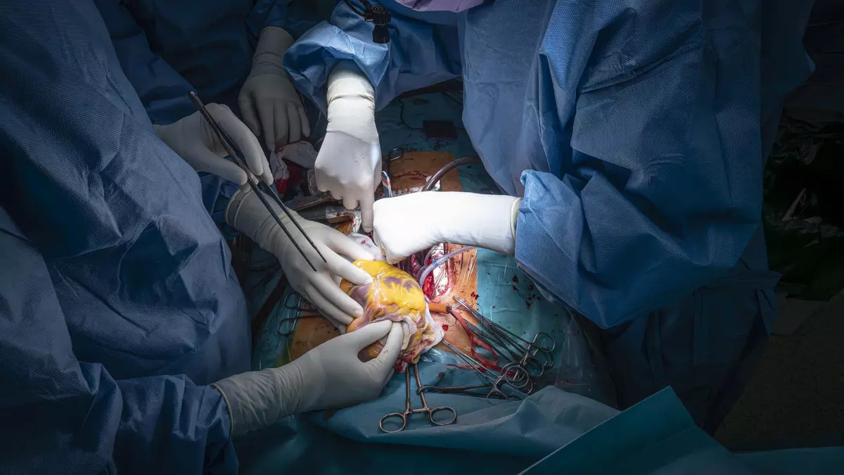 Las negativas a donar órganos en Catalunya aumentan y se sitúan ya en el 28% este 2025