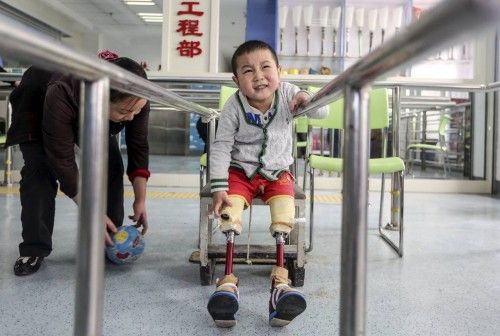 Boy reacts as he practises with his prosthetic legs at a hospital in Wuhan