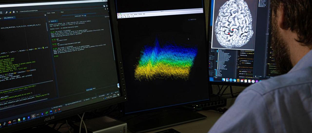 Un investigador trabaja en un estudio para conectar el cerebro de un paciente a un ordenador.