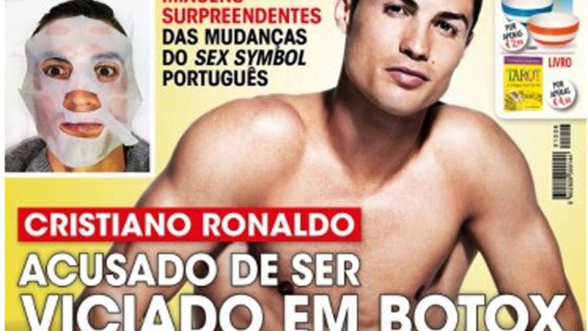 Cristiano Ronaldo es adicto al botox