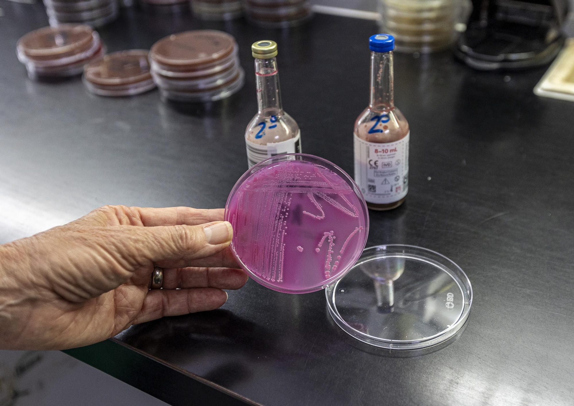 Protocolo para optimizar la respuesta rápida en código sepsis en Alicante