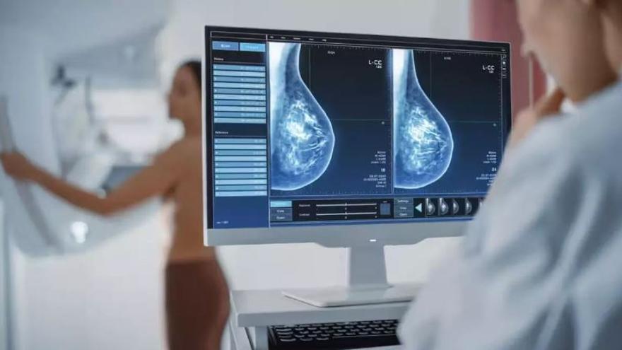 El Botànic dejó fuera de las mamografías de prevención del cáncer de mama a 167.083 mujeres mayores de 45 años