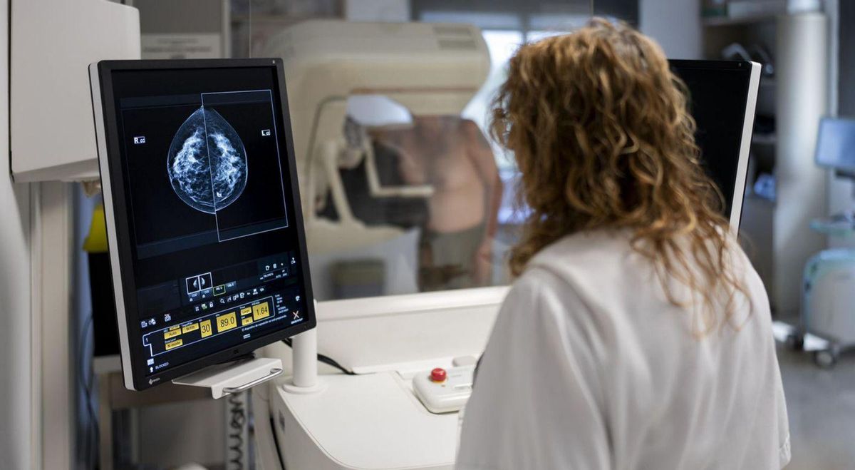 "Una mamografía preventiva cada dos años es insuficiente"