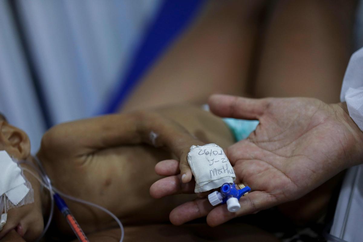 Niño indígenas yanomami desnutridos reciben tratamiento en el Hospital Infantil Santo Antonio en Boa Vista, estado de Roraima, Brasil.