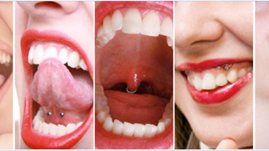 Piercings orales, una moda que pone en riesgo la salud bucodental