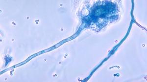 La presència del fong Aspergillus obliga a tancar un quiròfan de l’Hospital de Mataró