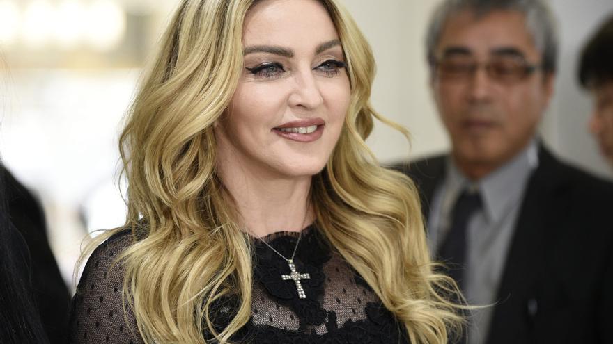 Este es el IMPACTANTE antes y después de Madonna tras pasar quirófano