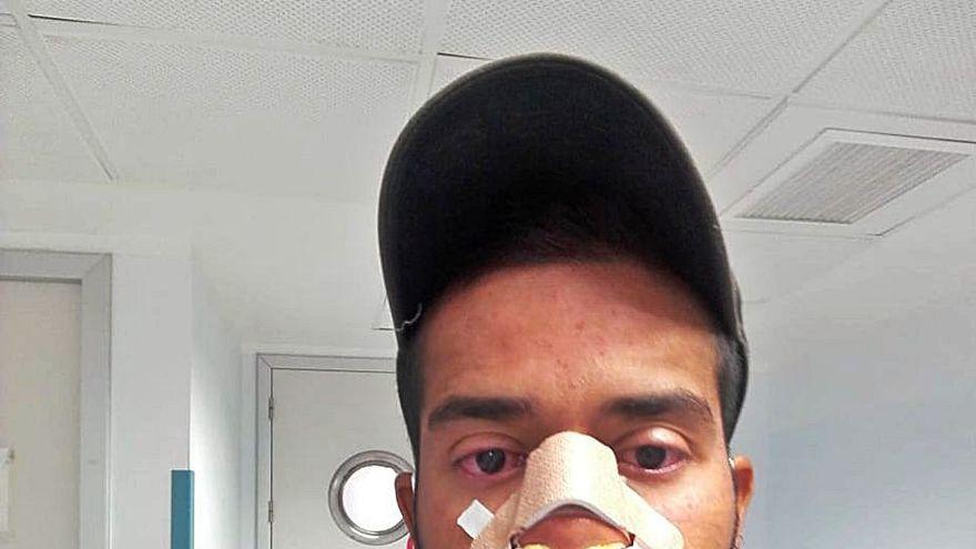 Rafael Parra, en el hospital, con el vendaje sobre su nariz rota.