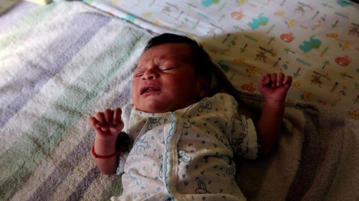 Un bebé con el virus zika.