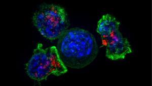 Células CAR-T (rojo y verde) rodeando células cancerosas (azul).