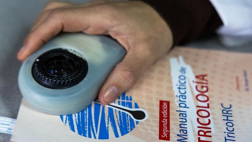 Una de cada cuatro jóvenes sufre excesiva caída del cabello y los peinados tirantes son una de las causas n