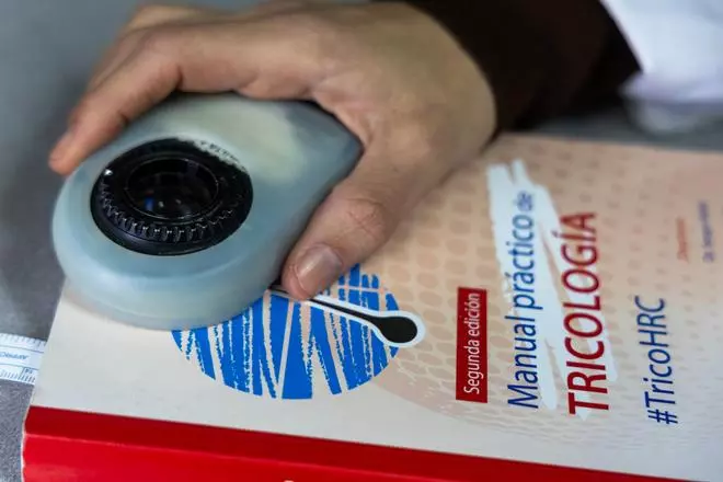 Una de cada cuatro jóvenes sufre excesiva caída del cabello y los peinados tirantes son una de las causas n