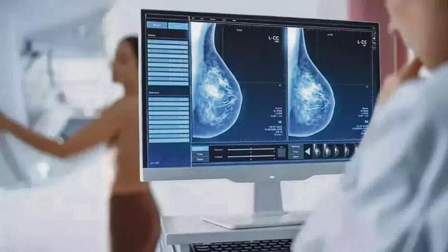 Mamografías