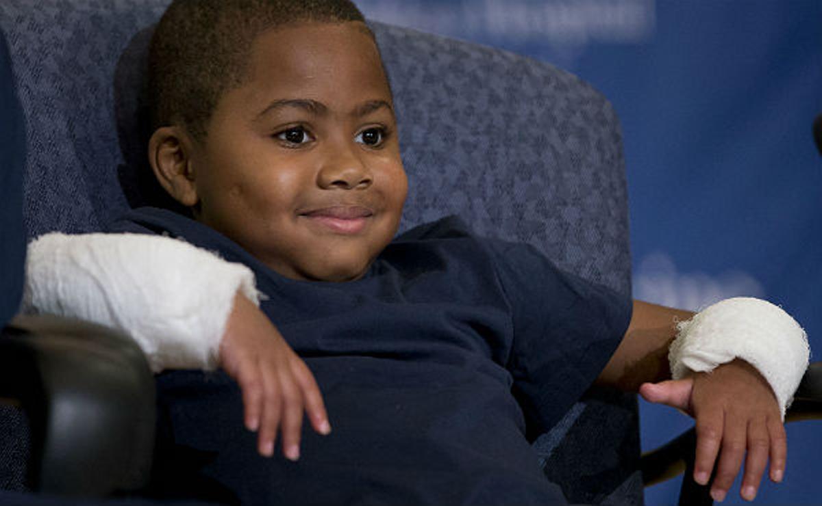 El niño de ocho años, Zion Harvey, sonríe en una conferencia en el Hospital Infantil de Filadelfia (CHOP) tras ser trasplantado de sus dos manos. 