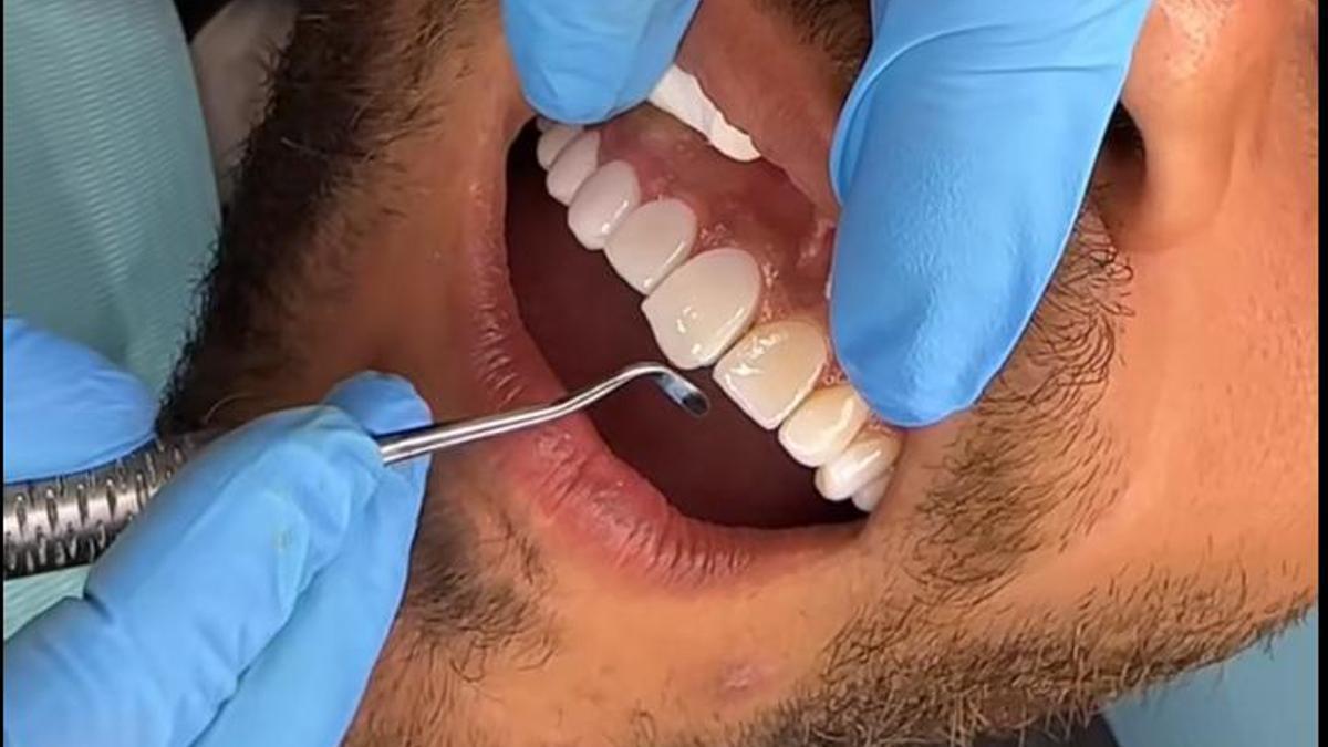 Et raspalles les dents així? Una dentista alerta del risc contra la salut