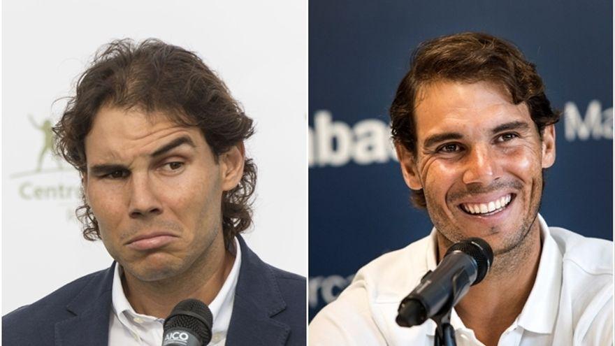 Rafa Nadal, antes y después de su injerto capilar.