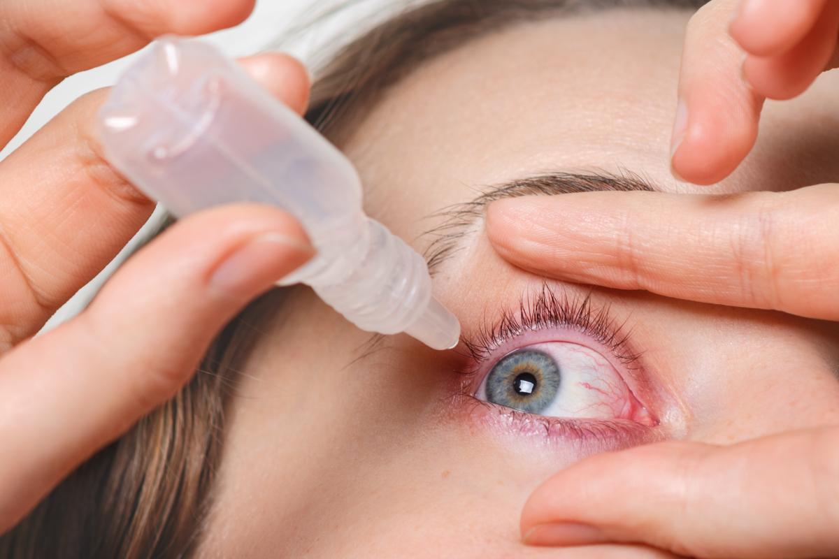 Conjunctivitis is another of the most common symptoms of seasonal allergies.