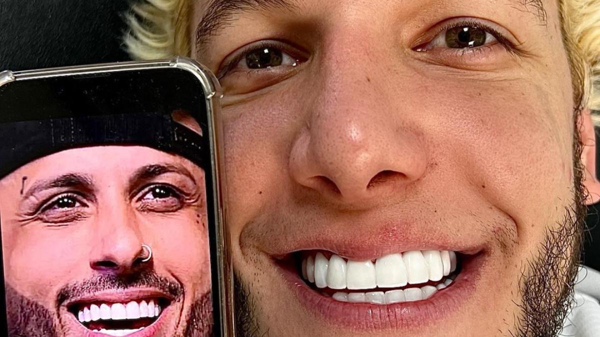 La foto más impactante de los dientes de Álex Caniggia ('GH VIP 8')