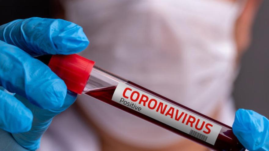 Trece muertos y 478 afectados por el coronavirus en Baleares