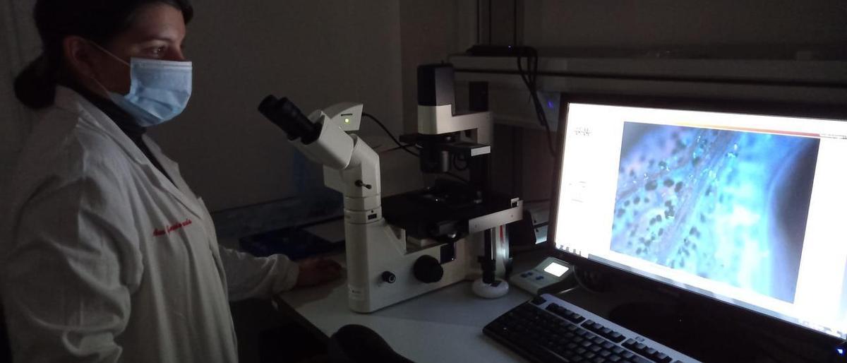 La investigadora, Ana García, los tricomas glandulares de 'Artemisia annua', lugar en el que se acumula la artesimisina.