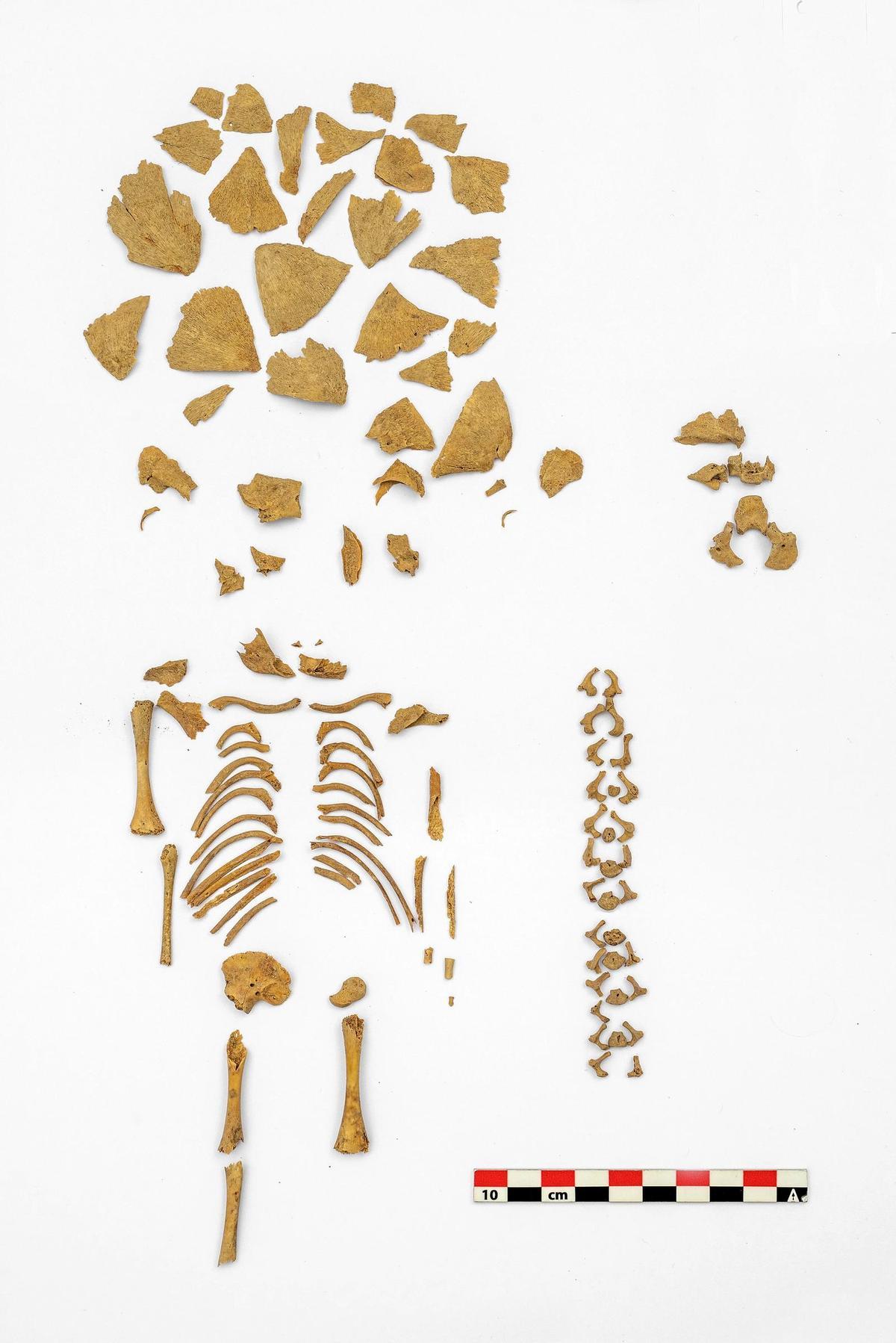 Uno de los esqueletos de un niño con síndrome de Down analizados por el equipo.