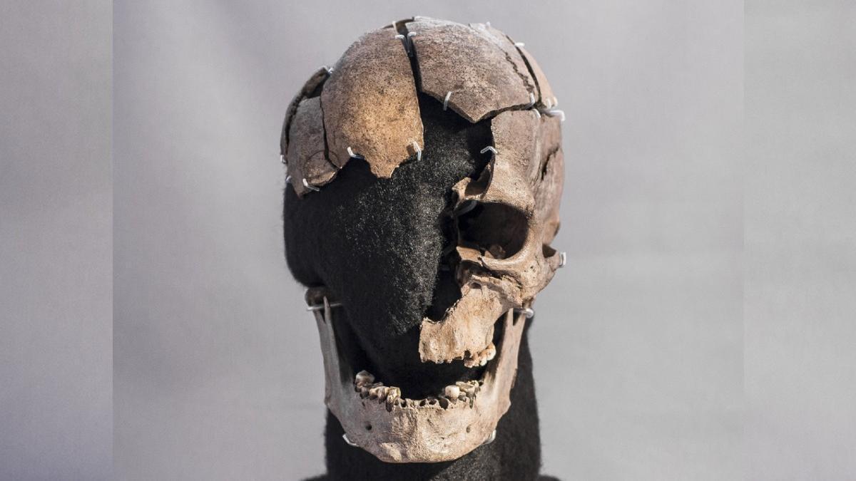 Cráneo del hombre de Vittrup, asesinado en Dinamarca hace 5.200 años.