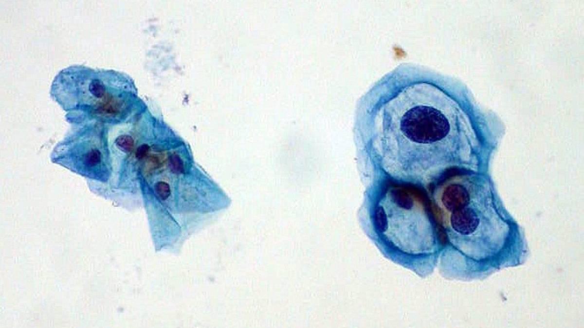 Imagen del virus del papiloma humano.