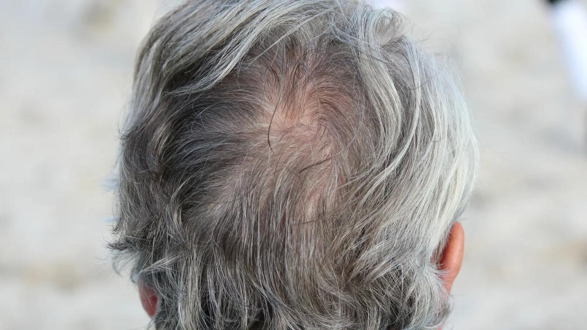 Una persona con canas