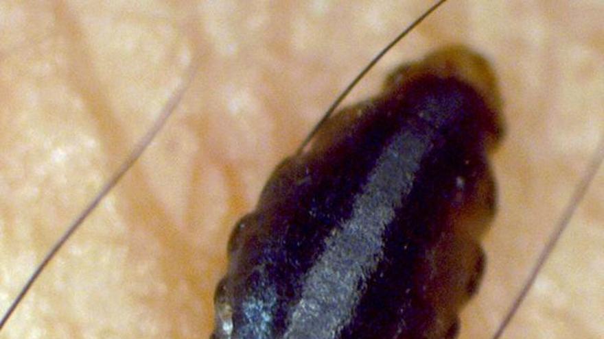 Un equipo de científicos secuencia el curioso genoma del piojo