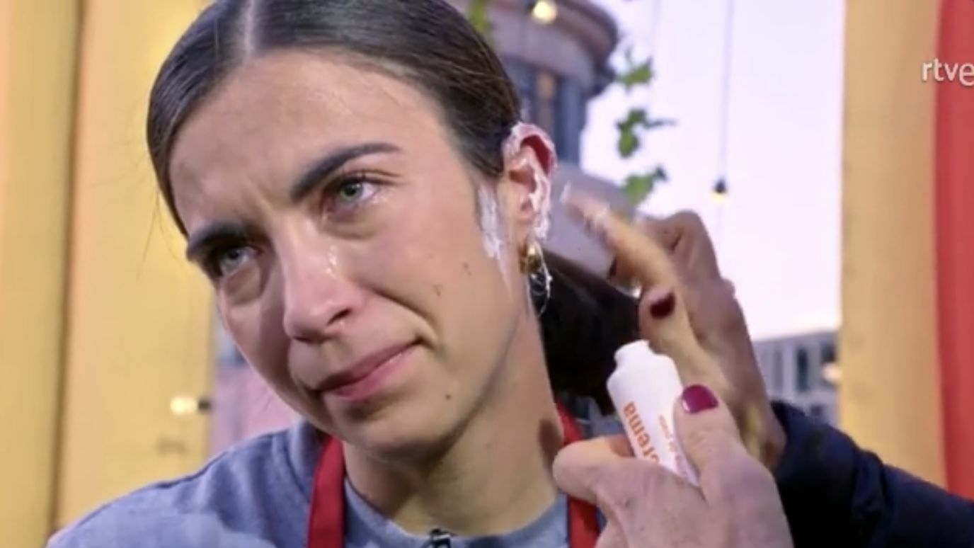 Accidente en 'Masterchef'