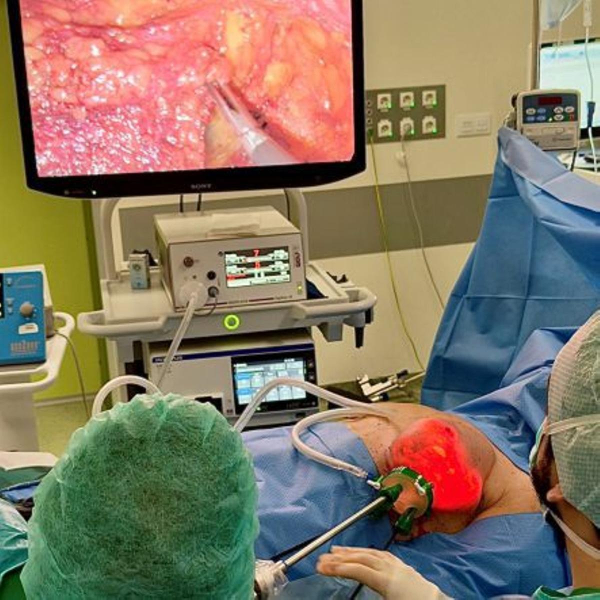 Imagen de la intervención. | FDV