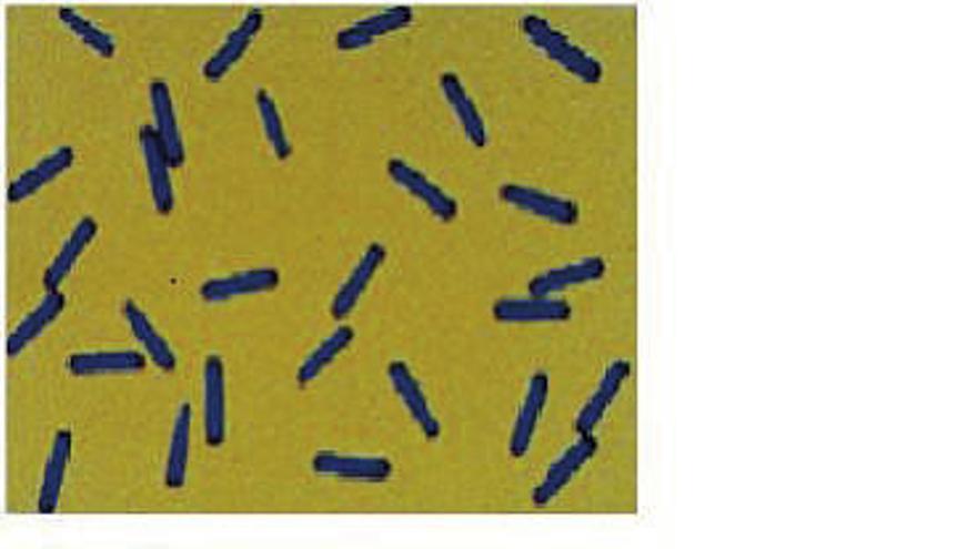 Bacilos Clostridium difficile.