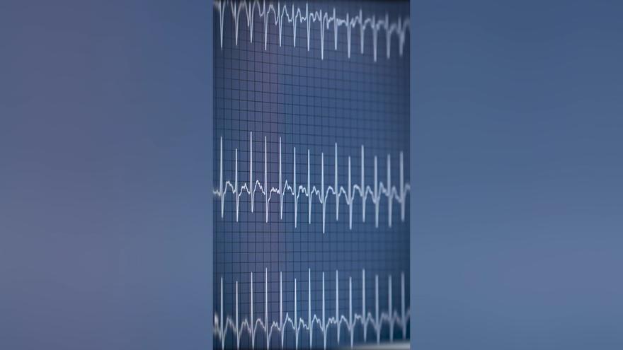 Illya Zabarny llegó al PSG procedente del Bournemouth