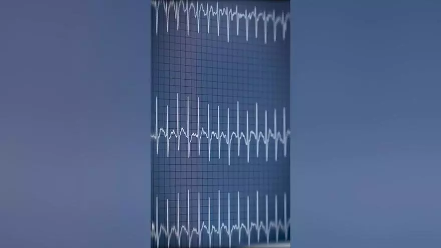 Illya Zabarny llegó al PSG procedente del Bournemouth