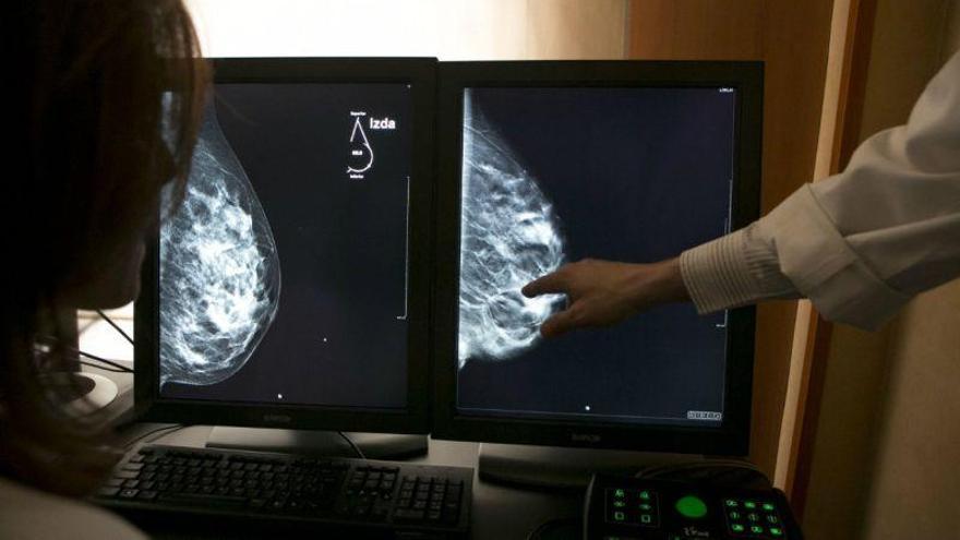 Condenada una ginecóloga de Barcelona por tardar 5 meses en detectar un cáncer