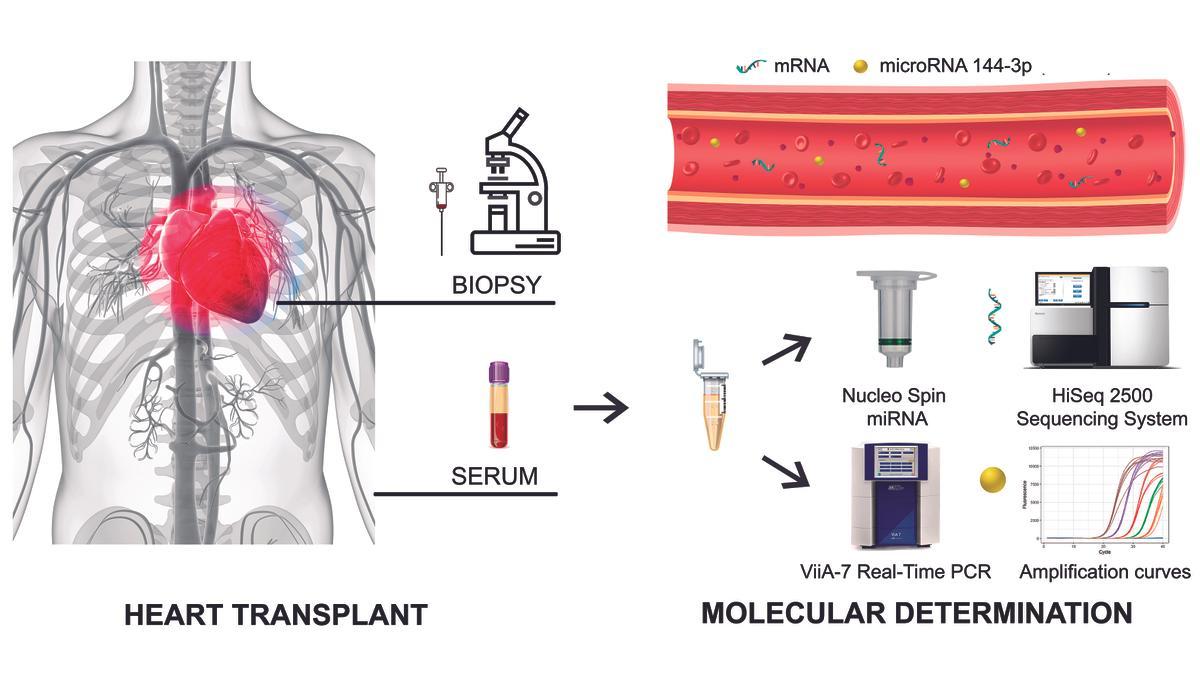 Gráfica resumen de &#039;Diagnostic value of serum miR-144-3p&#039;.