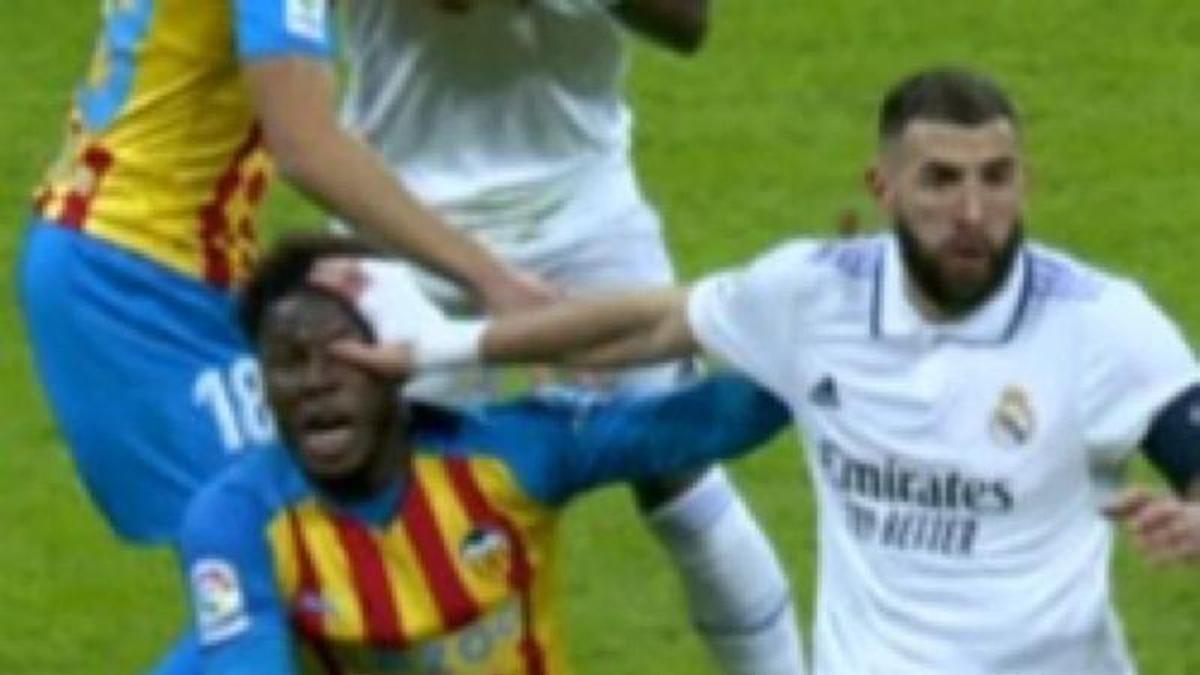 Imagen en la que se ve como Benzema pone la mano en la cara de Yunus